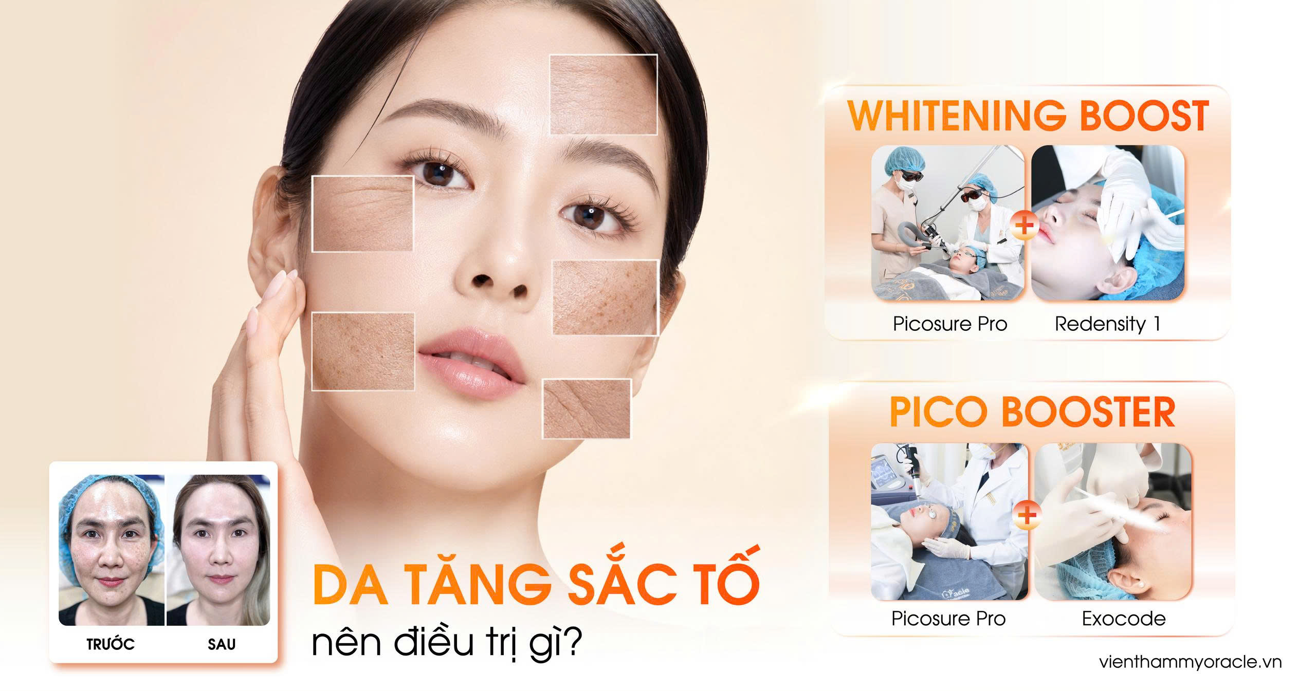 da tăng sắc tố