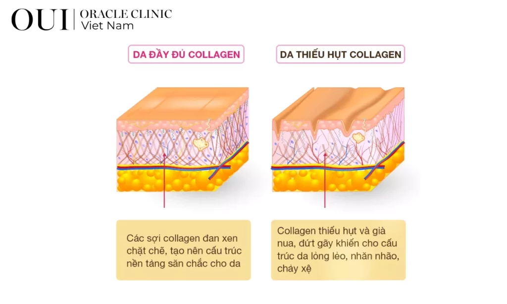 da thiếu collagen