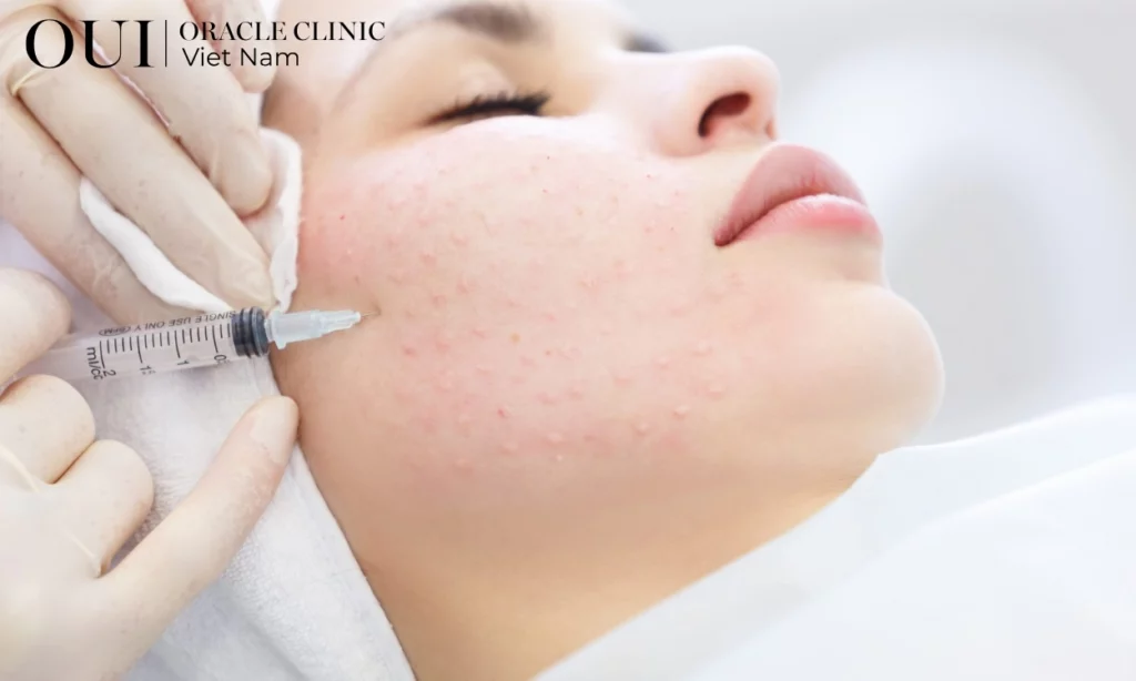 da thiếu collagen