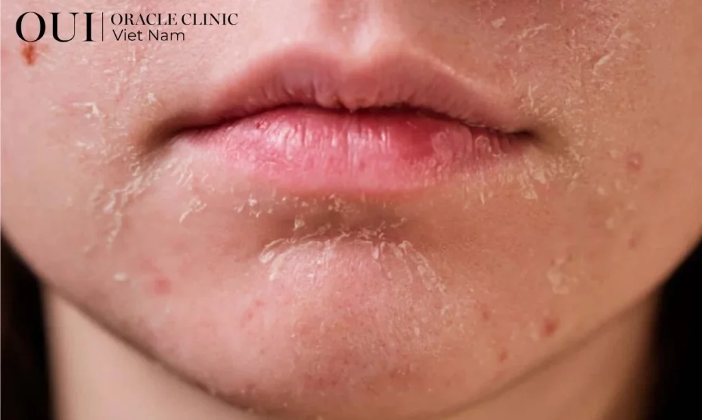 da thiếu collagen