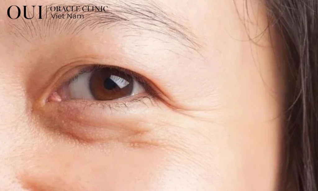 da thiếu collagen