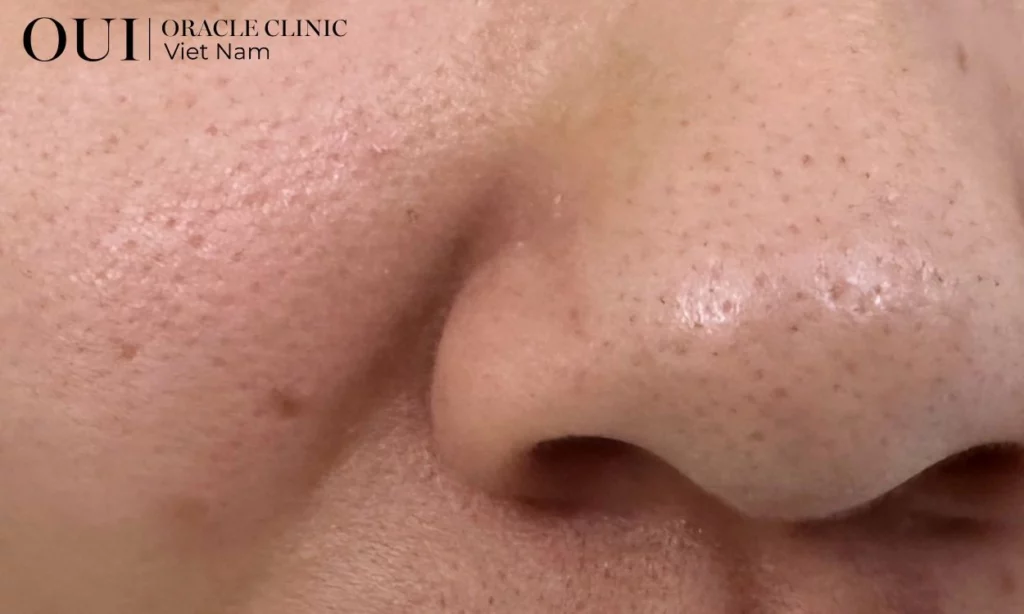 da thiếu collagen