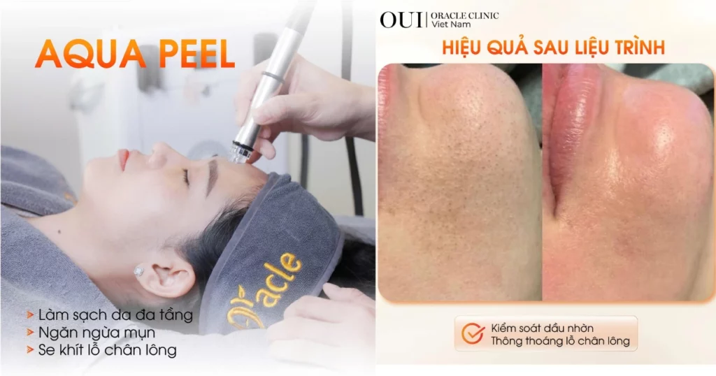 da xuống cấp do nắng nóng