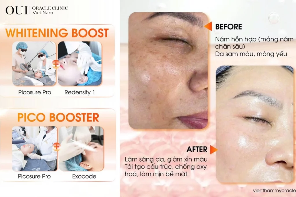 dân văn phòng bị nám