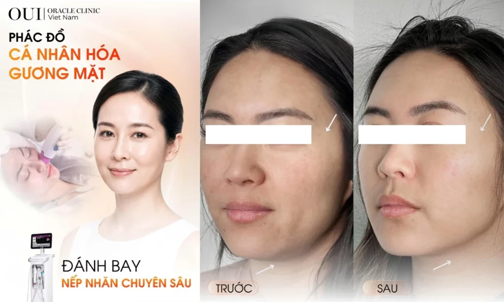 Dân văn phòng lão hóa sớm