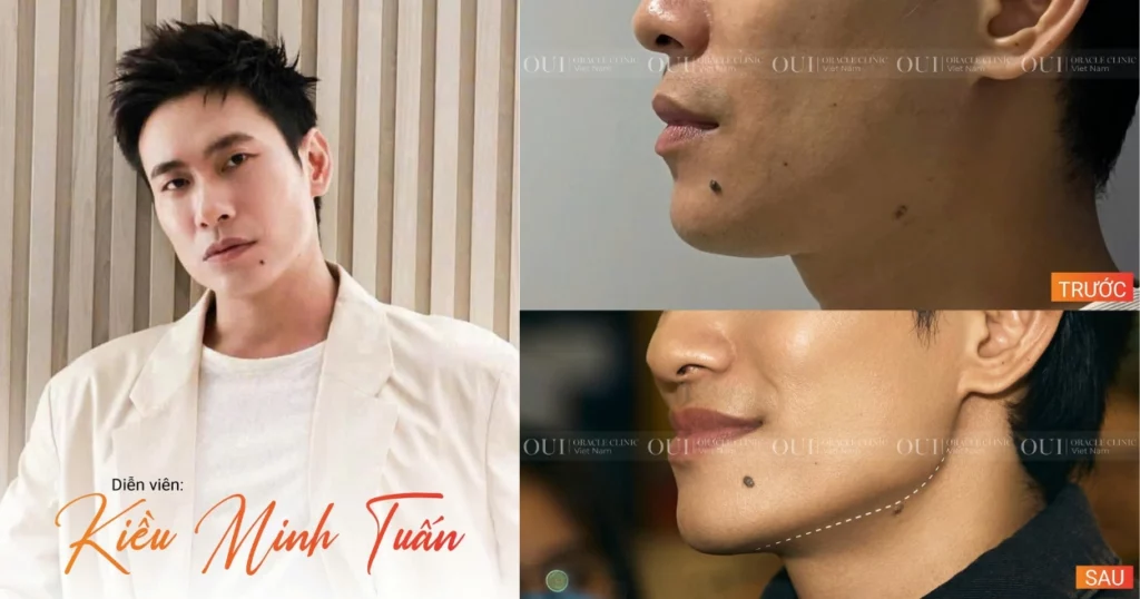 làm sao để trẻ lâu sau tuổi 30