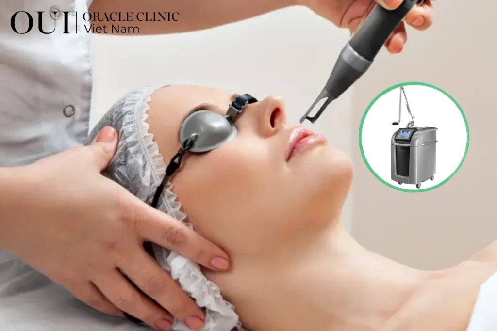 laster pico trị nám vùng nào