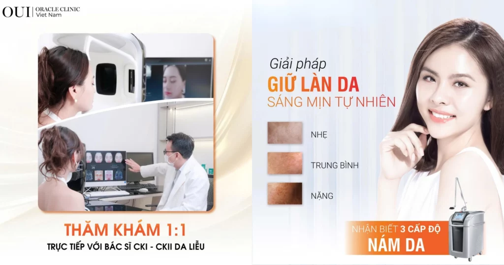 Nám nội tiết có trị hết không?