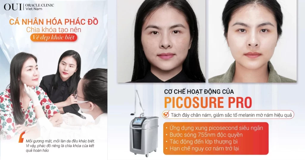 Nám nội tiết có trị hết không?