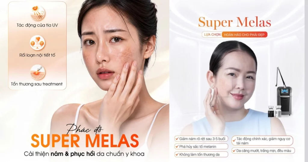 Nám nội tiết có trị hết không?