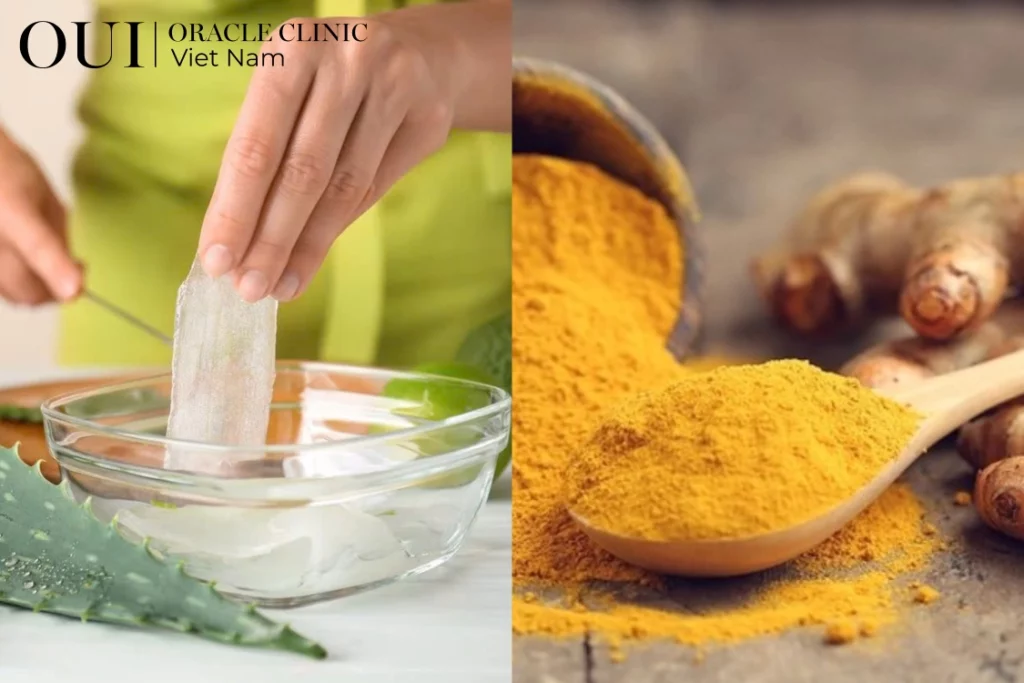 nám sau sinh bao lâu mới hết