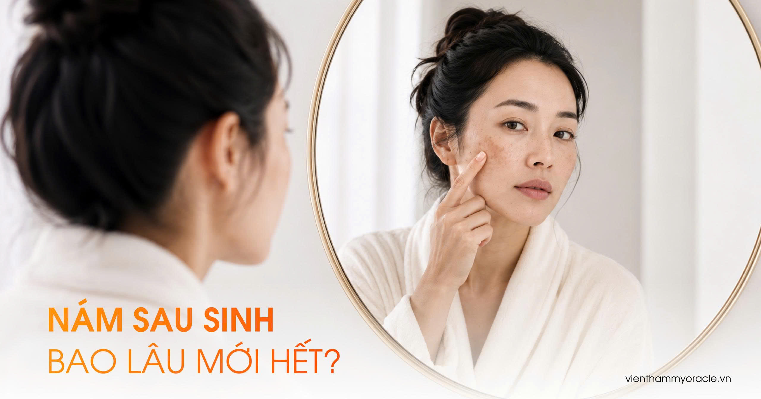 nám sau sinh bao lâu mới hết