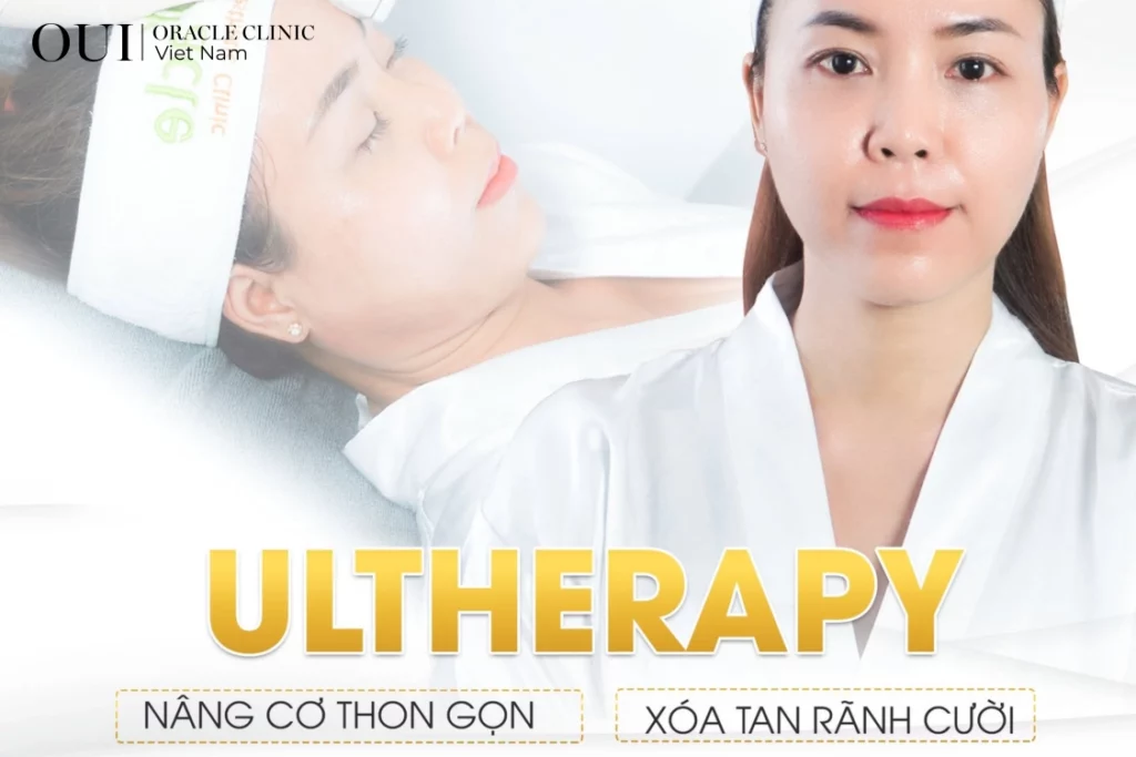 nâng cơ mặt chảy xệ