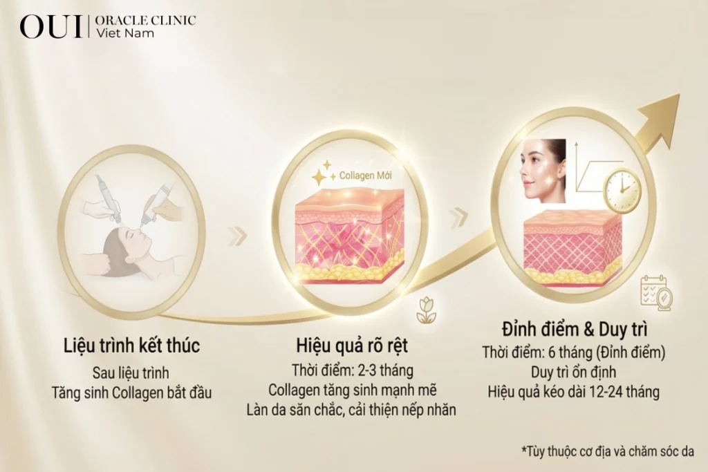 nâng cơ mặt chảy xệ
