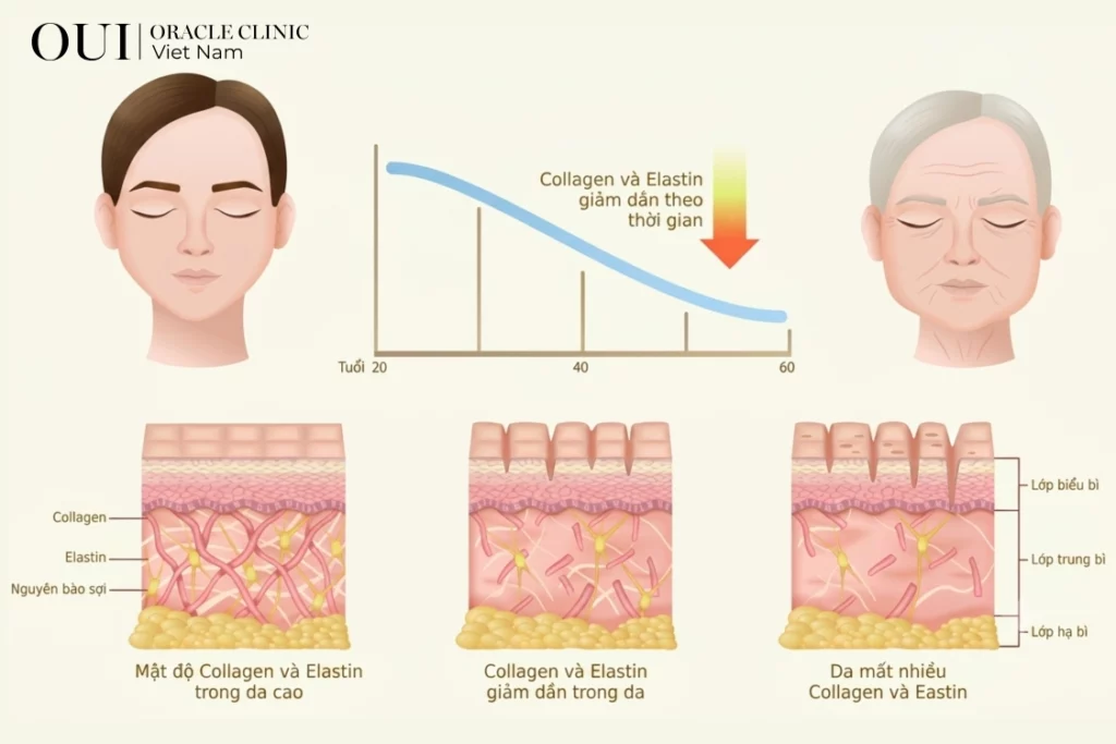 nâng cơ mặt chảy xệ
