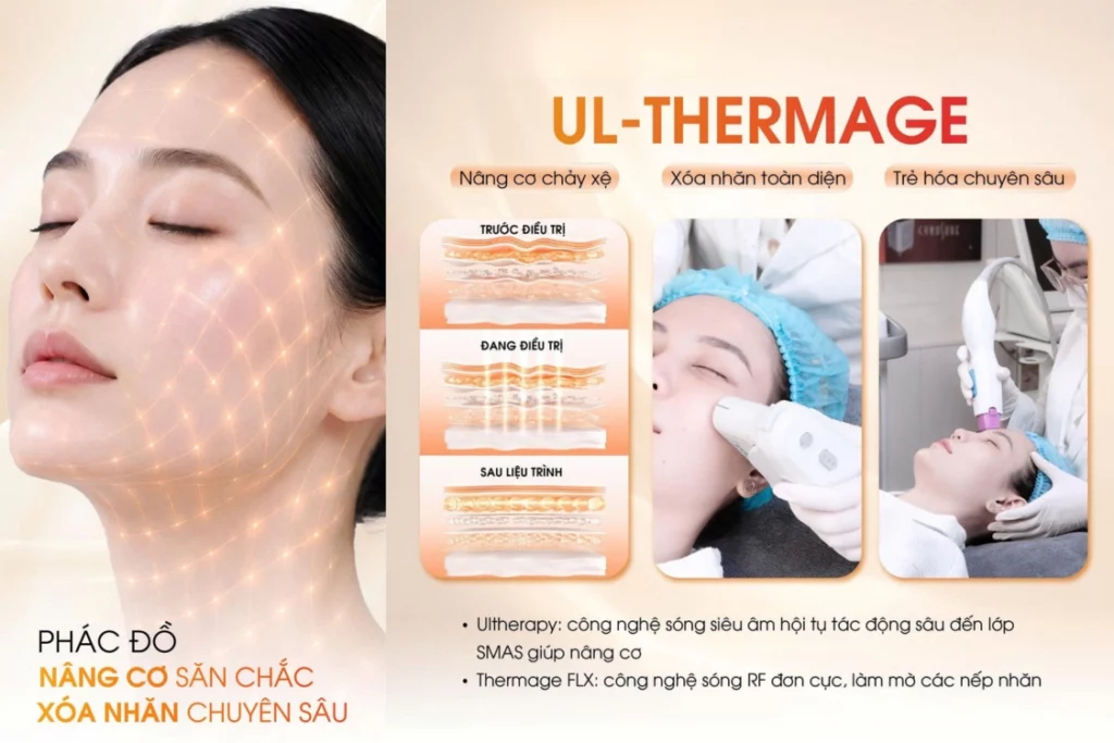 nâng cơ mặt chảy xệ