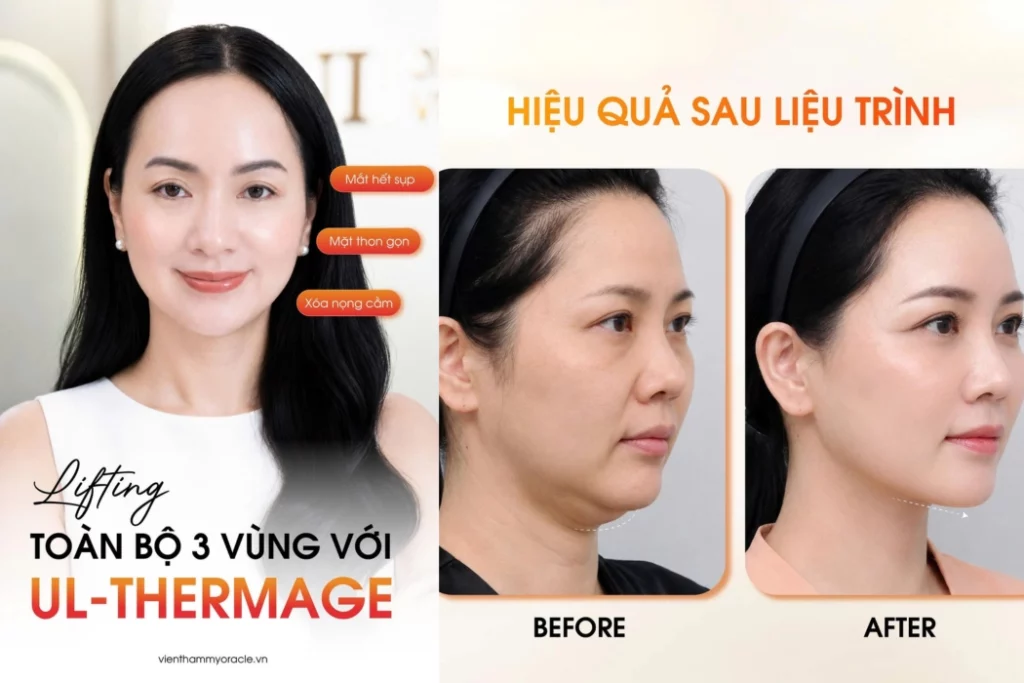 phụ nữ sau 30 xuống sắc nhanh