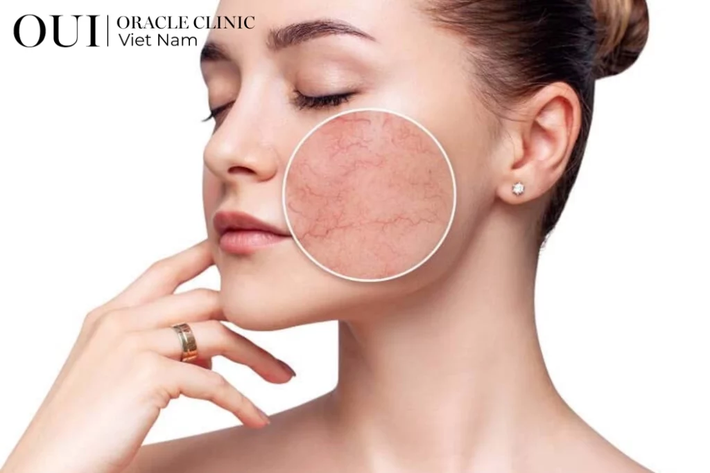 phụ nữ sau 30 xuống sắc nhanh