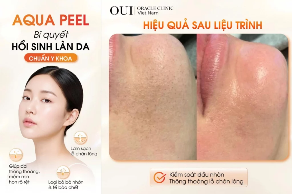 Skincare tối giản cho người bận rộn