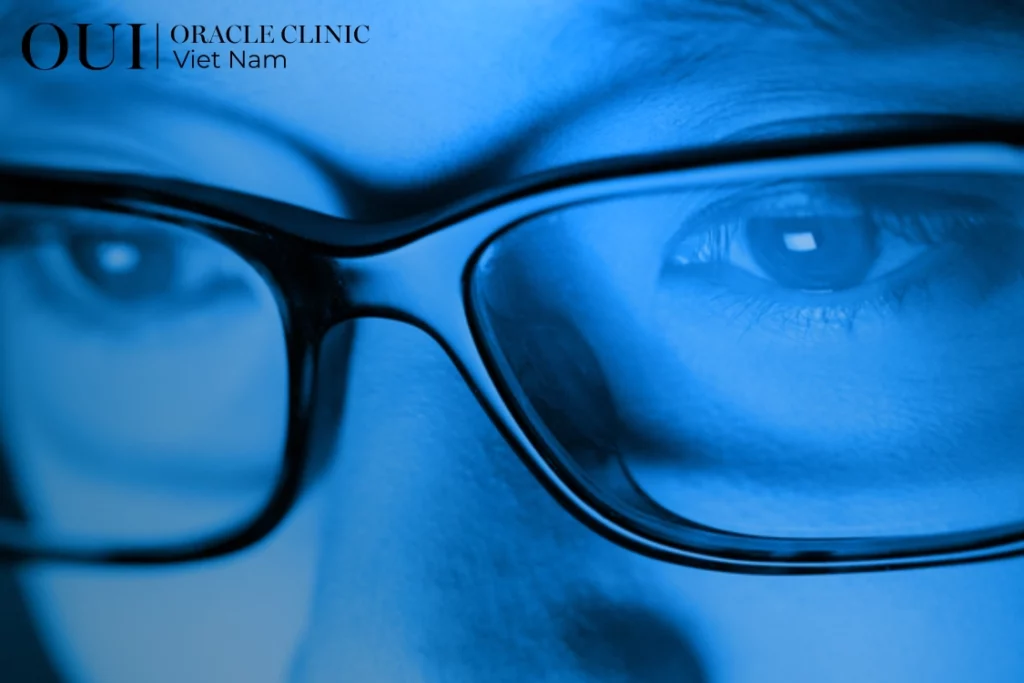 Thermage FLX có cần làm lại không?