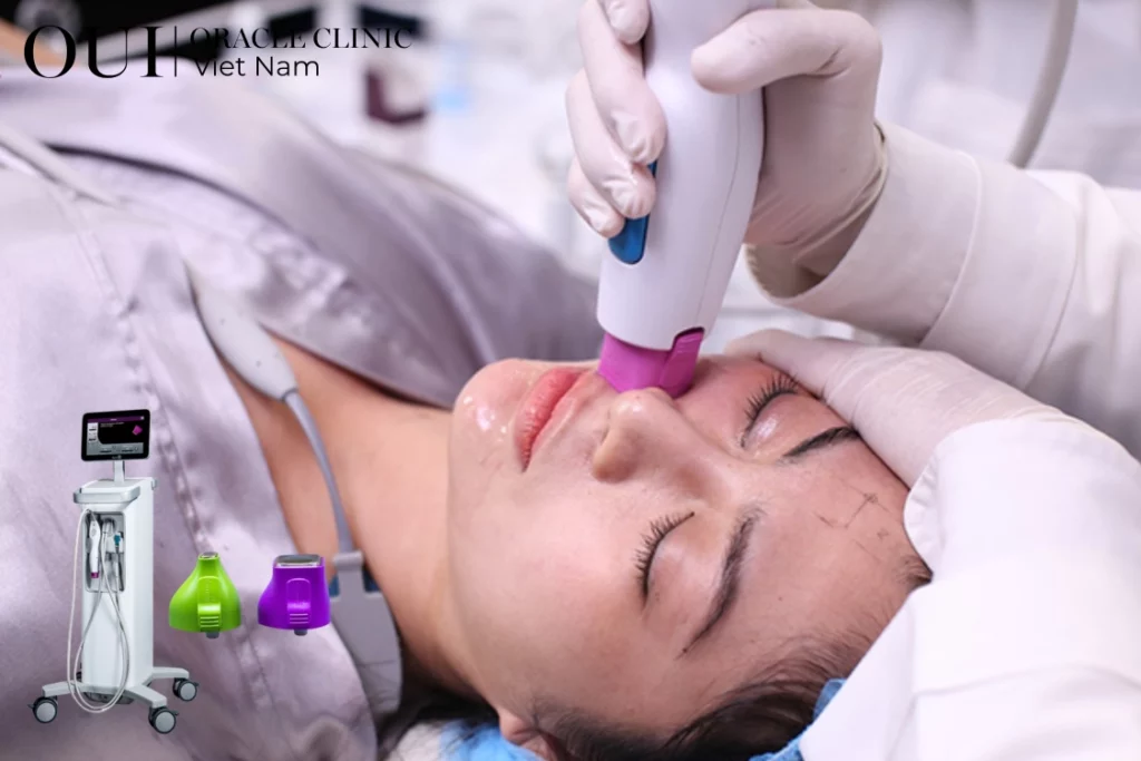 Thermage FLX có cần làm lại không?
