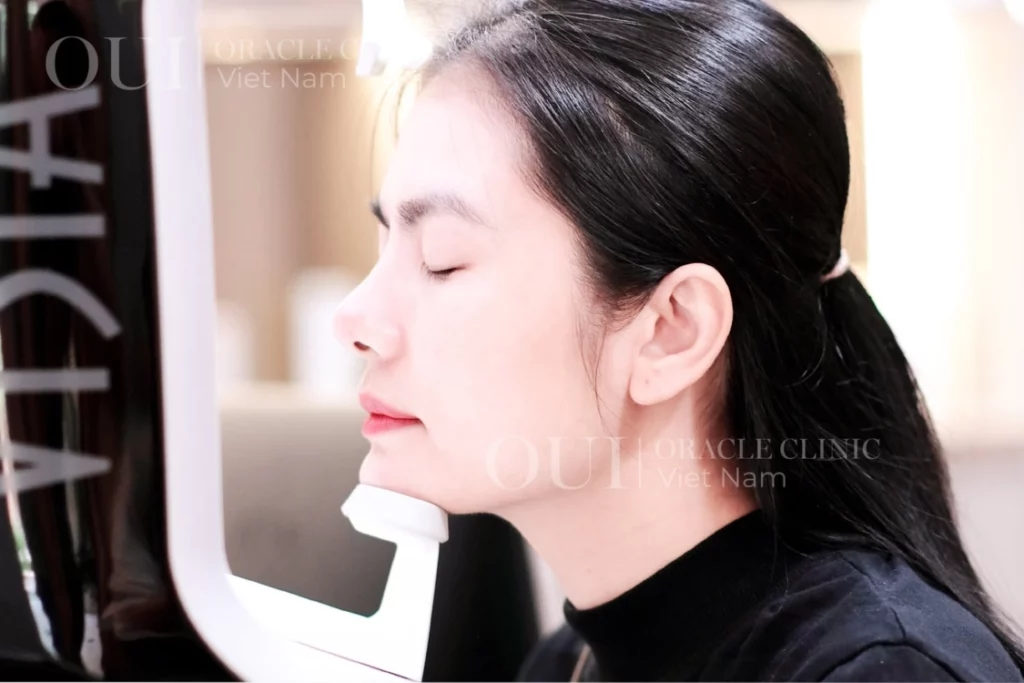 Thermage FLX có cần làm lại không?