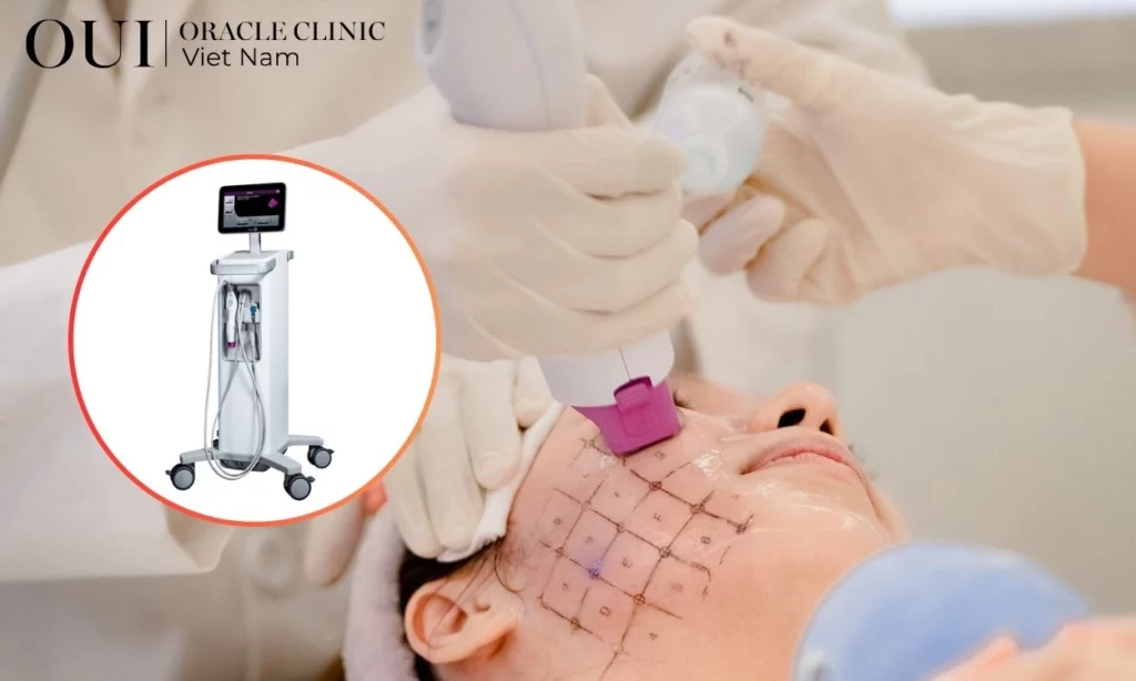 thermage phù hợp với ai