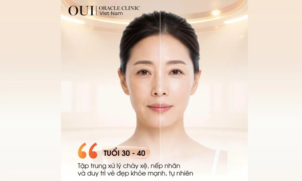 thermage phù hợp với ai