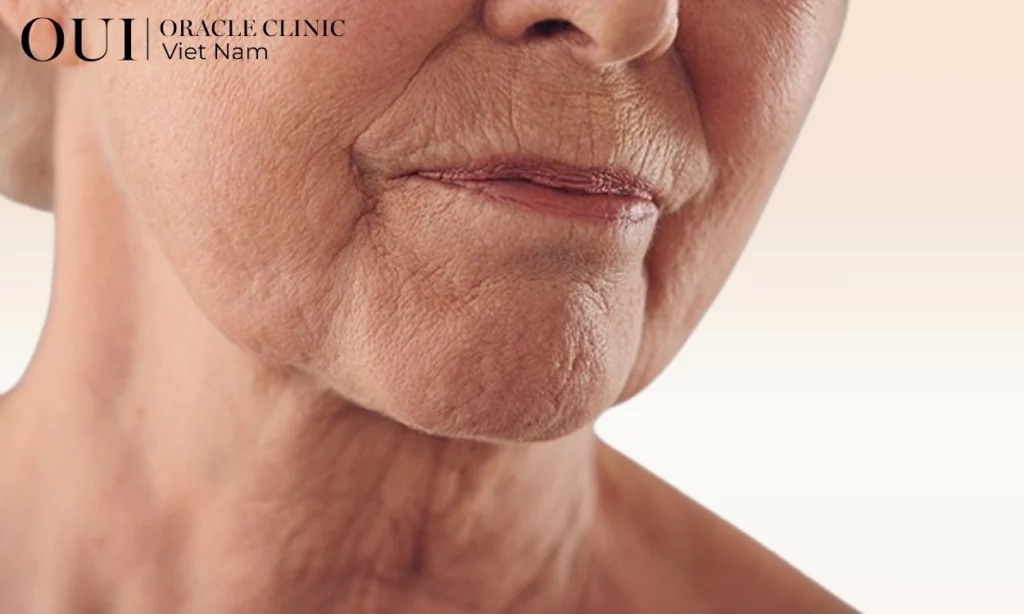 thermage phù hợp với ai