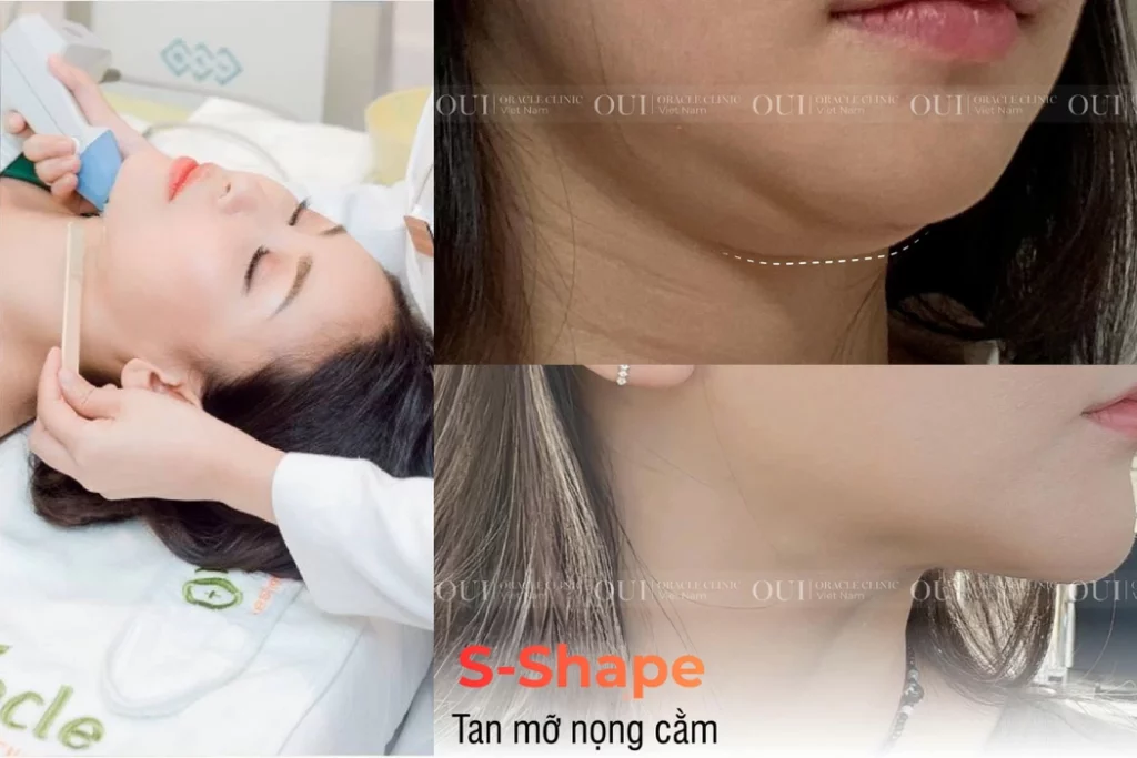 Trẻ hóa da cho người bận rộn