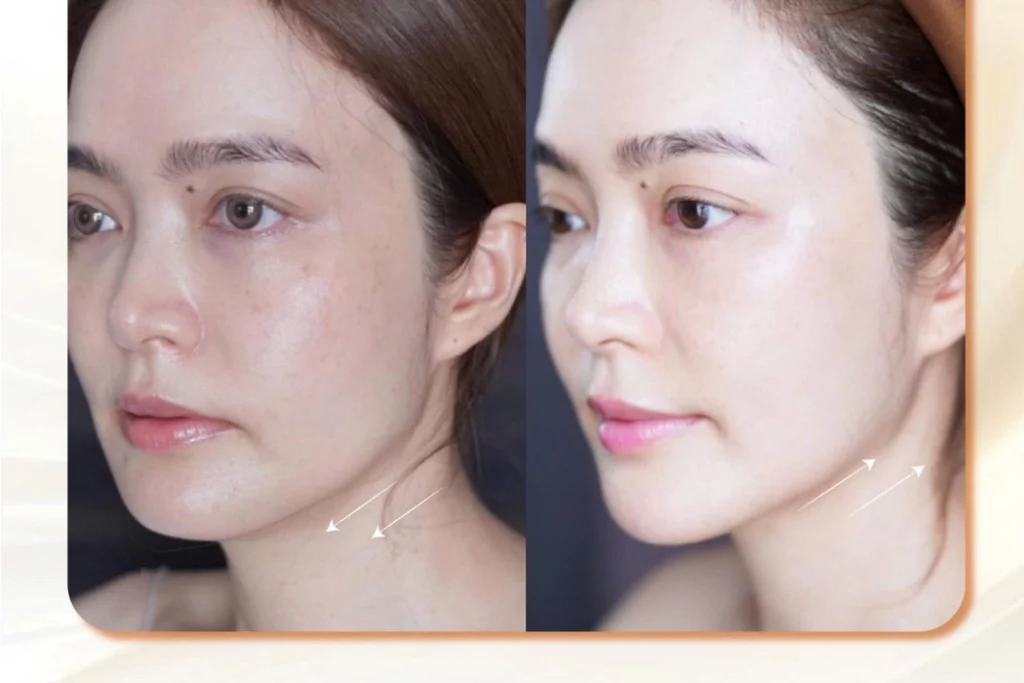 Trẻ hóa da cho người bận rộn