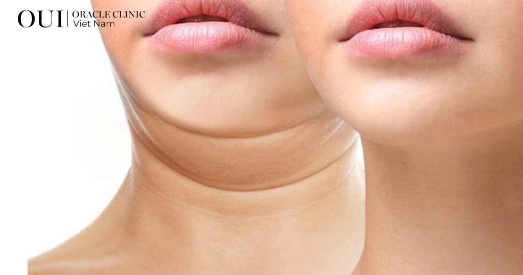 trẻ hóa không nghỉ dưỡng