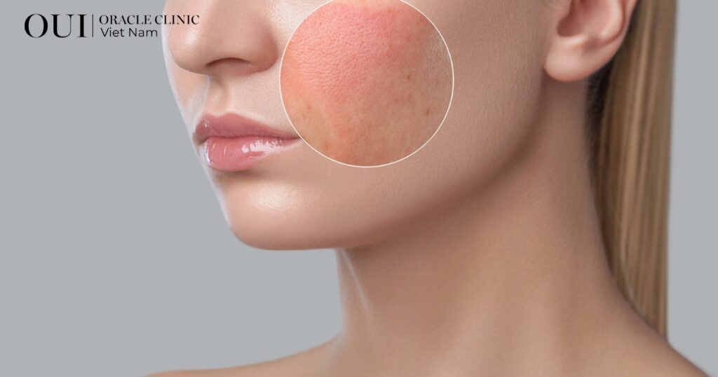 trẻ hóa không nghỉ dưỡng