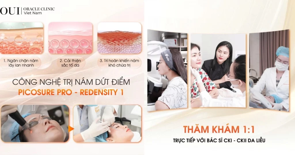 trị nám chuẩn y khoa