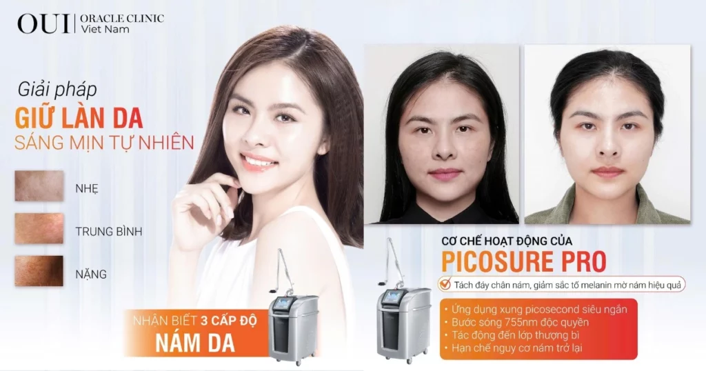 trị nám chuẩn y khoa