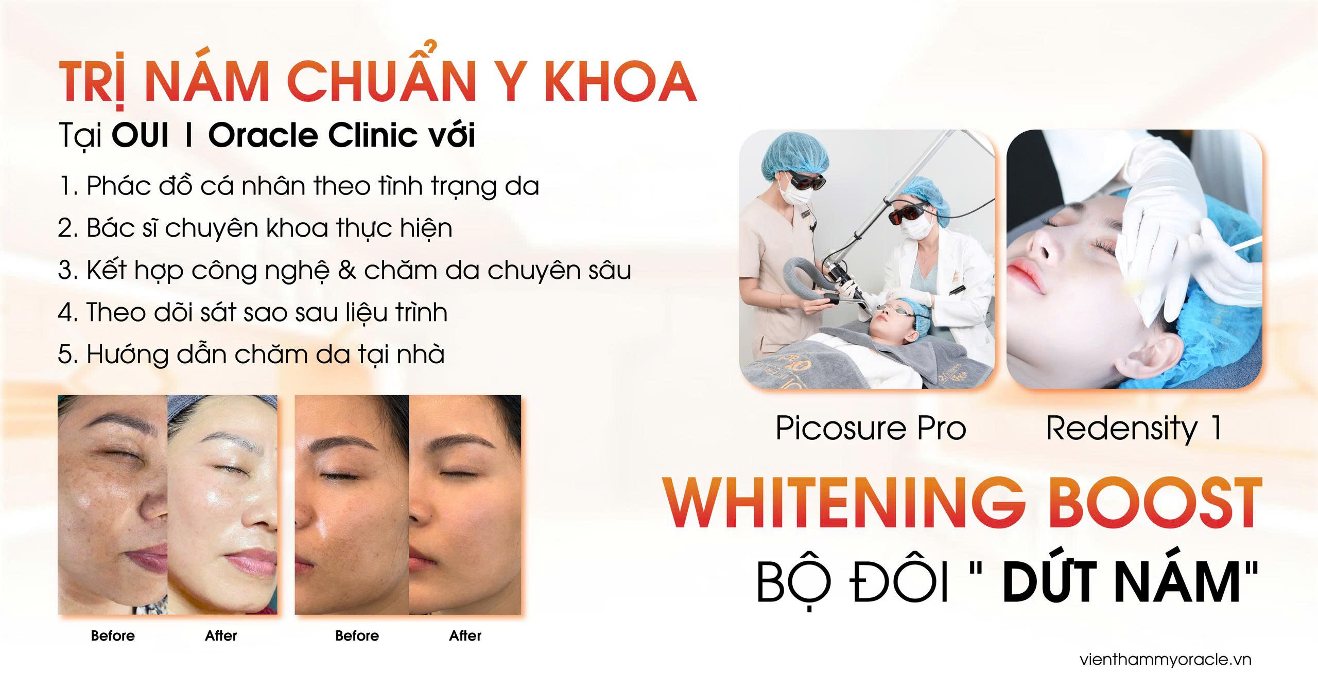 trị nám chuẩn y khoa