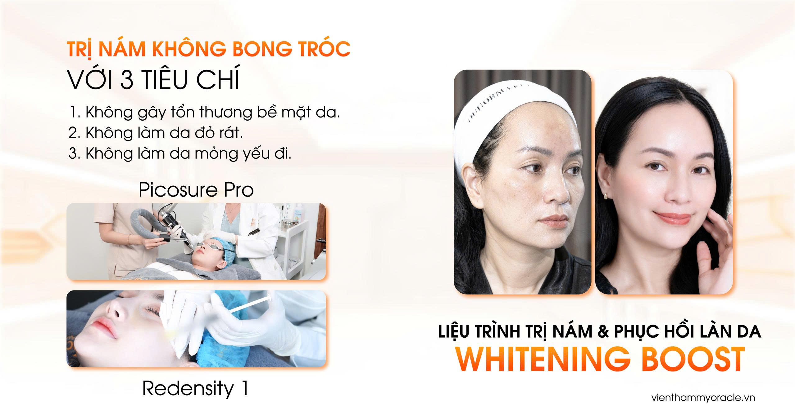 trị nám không bong tróc