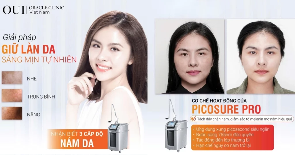 trị nám sau sinh