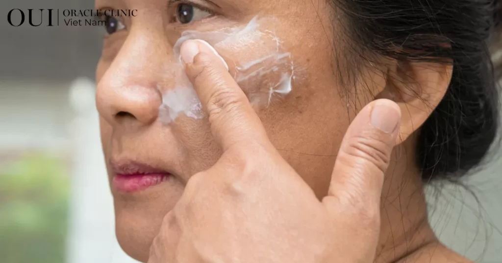 trị nám sau sinh