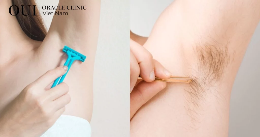 triệt lông có giúp da đều màu hơn không?