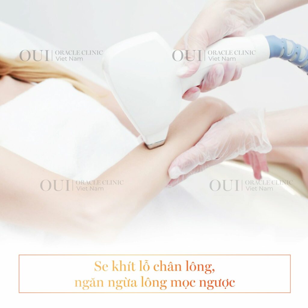 triệt lông có giúp da đều màu hơn không?