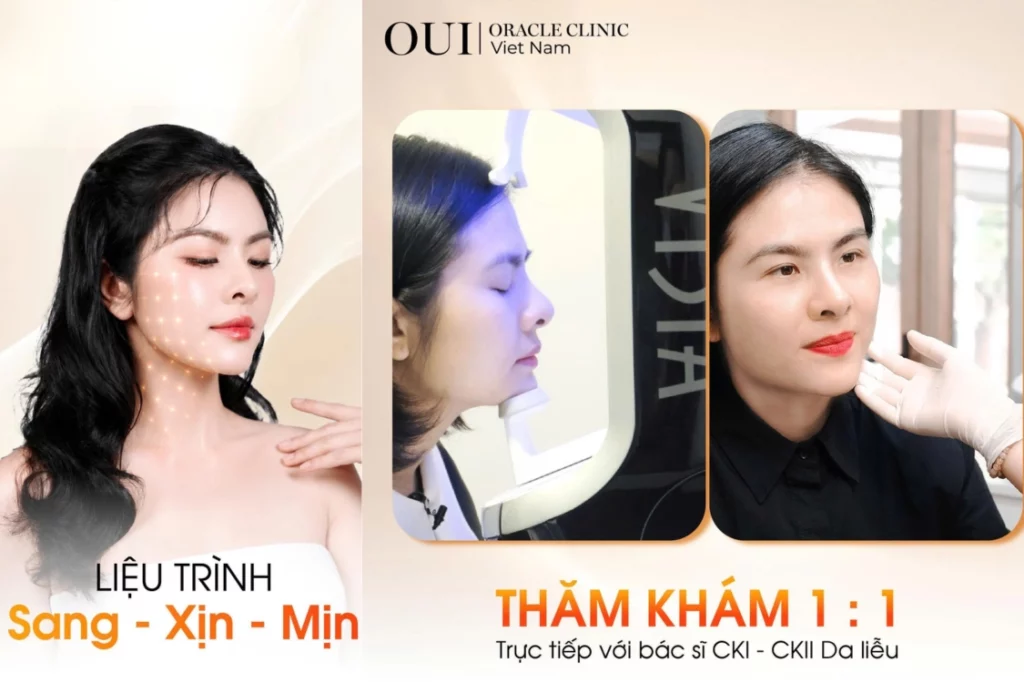 ultherapy có giảm nọng cằm không