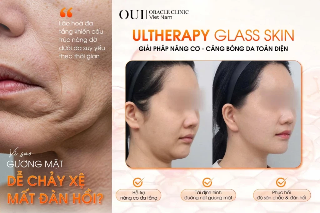 ultherapy có giảm nọng cằm không