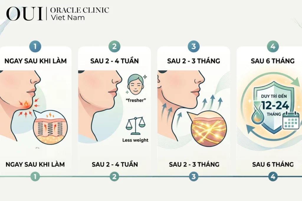 ultherapy có giảm nọng cằm không