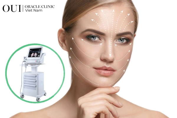 Ultherapy toàn mặt