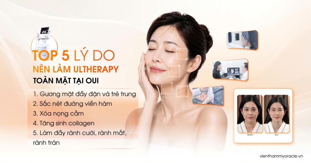 ultherapy toàn mặt