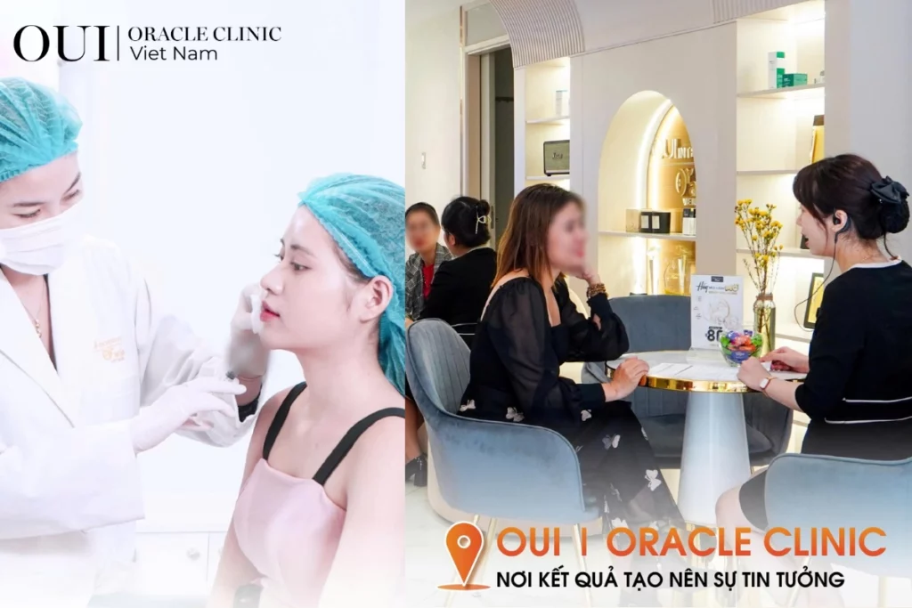 Ultherapy toàn mặt