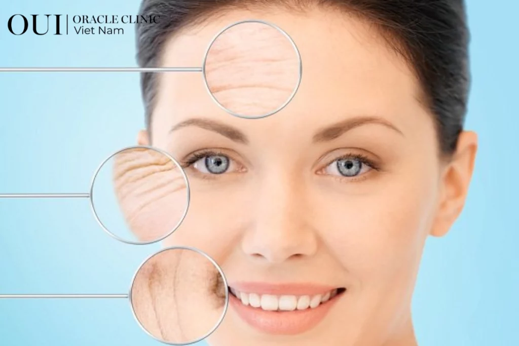 Ultherapy toàn mặt