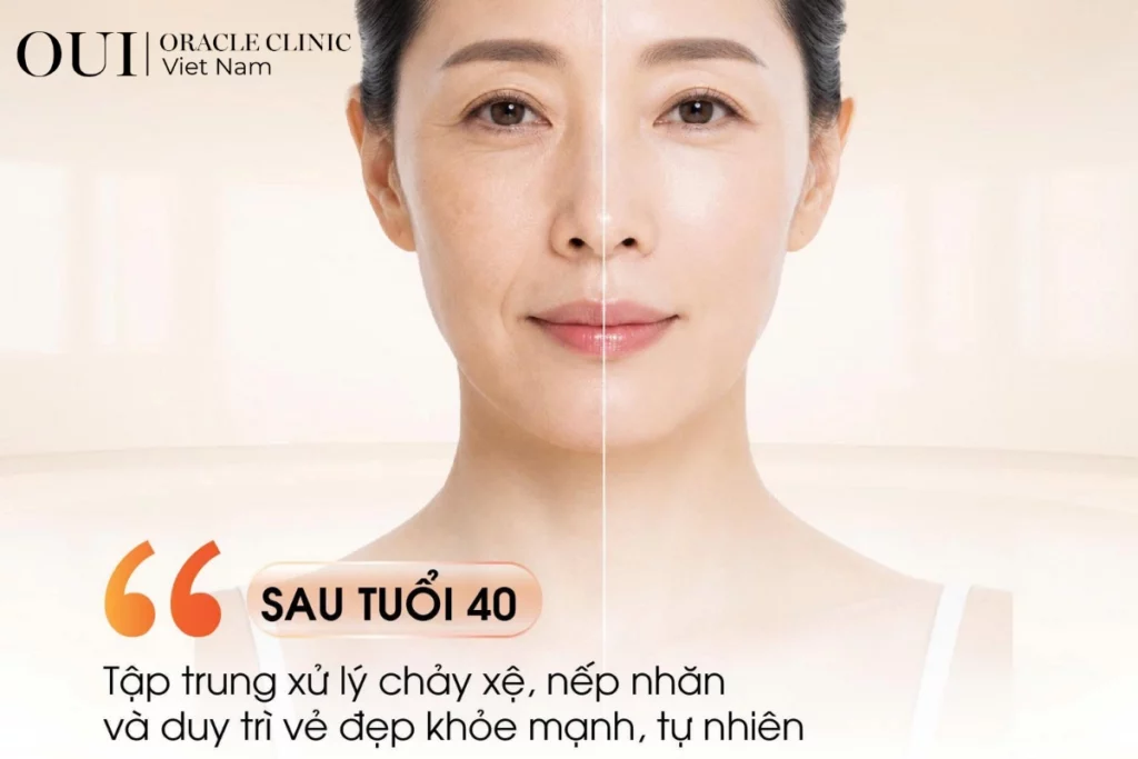 Ultherapy toàn mặt