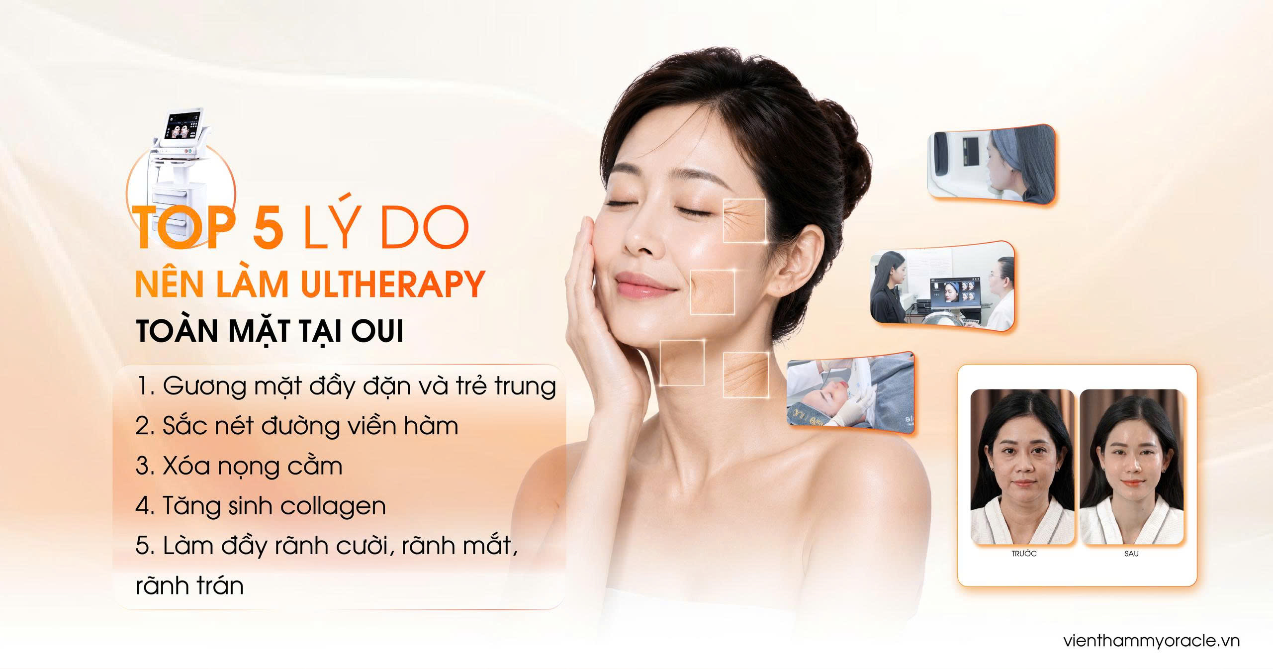 ultherapy toàn mặt